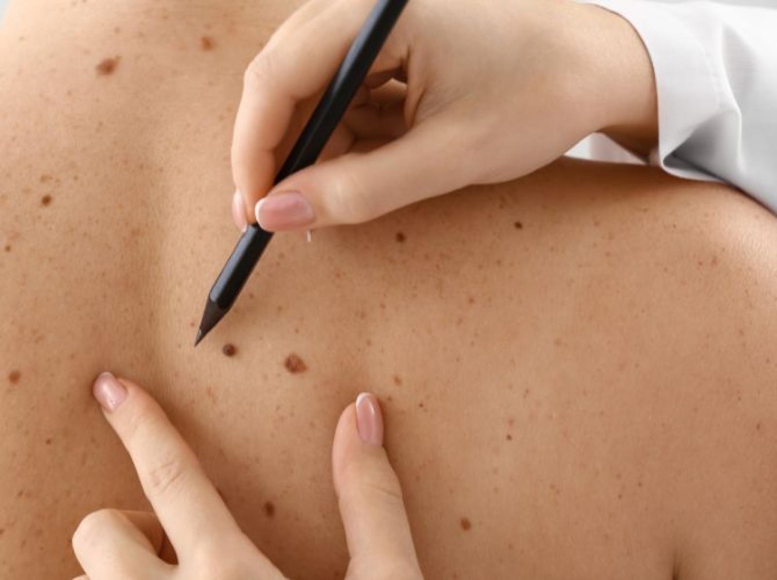 Comprehensive Skin Health Care at The Madison Medical Practice Hornsby